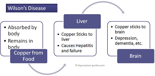 Wilson Disease Flowchart